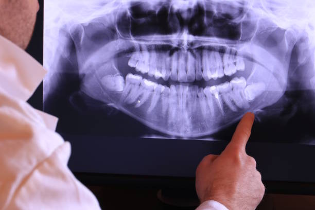 Tooth Infection Emergency Dentist in OK